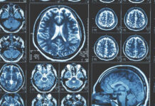 Διεθνής Ημέρα Ακτινολογίας: Εκρηκτική εξέλιξη τα τελευταία χρόνια