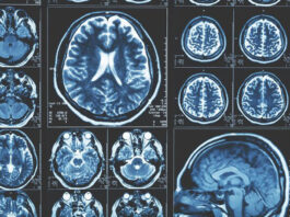 Διεθνής Ημέρα Ακτινολογίας: Εκρηκτική εξέλιξη τα τελευταία χρόνια